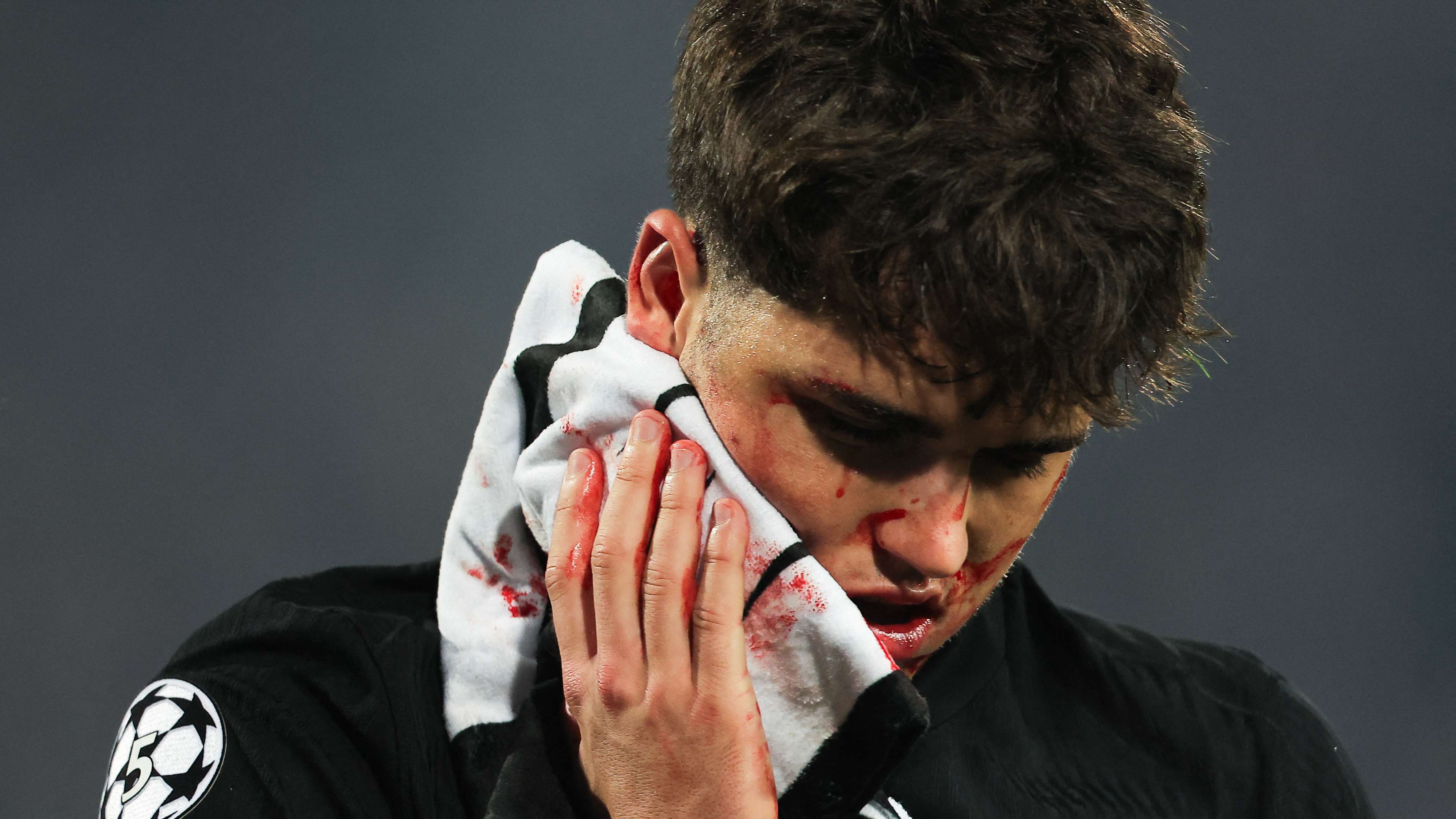 Cubarsi set to wear protective head mask after horror injury  